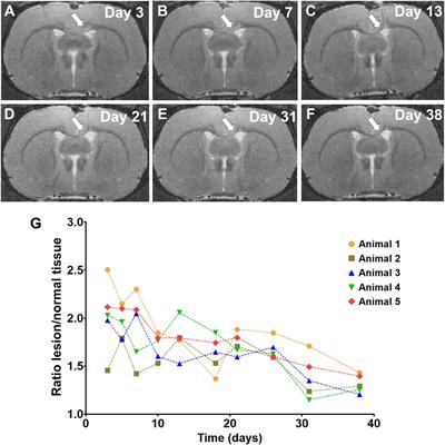 RAFF-4, Magnetization Transfer and Diffusion Tensor MRI of Lysophosphatidylcholine Induced Demyelination and Remyelination in Rats